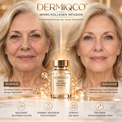 ANTI-FALTEN SERUM